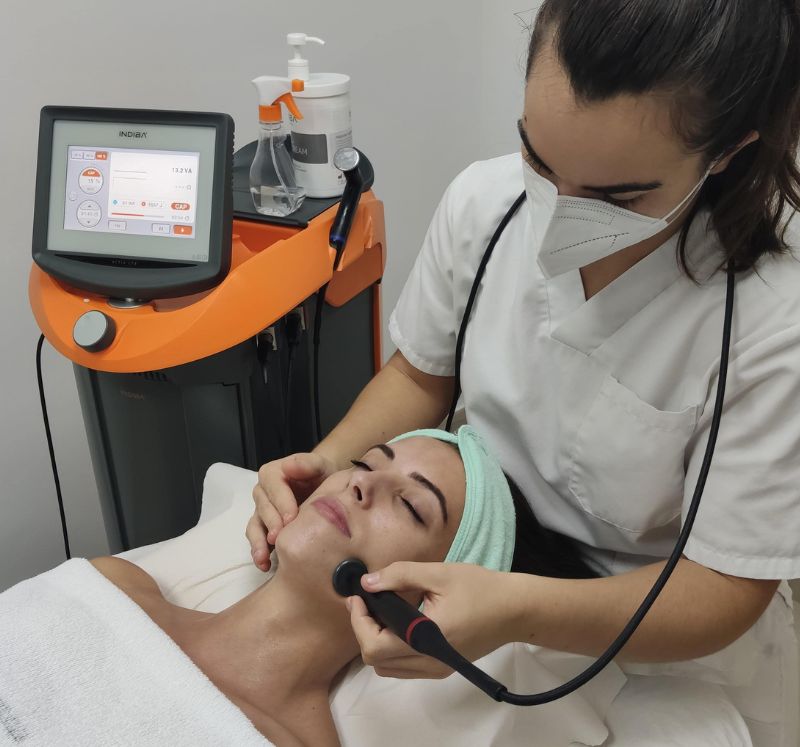 tratamientos estética laser fisioesport